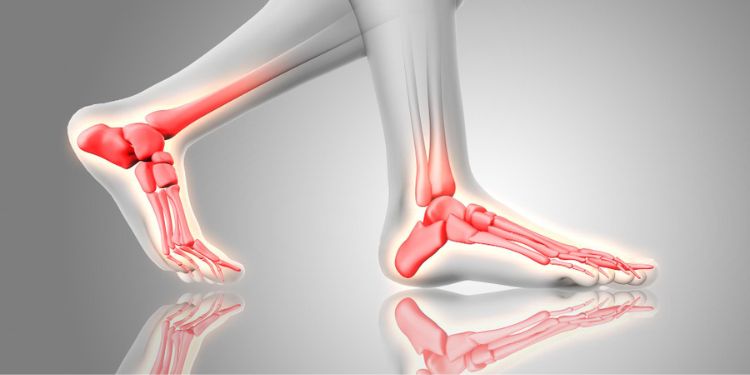 Journal of Sports and Exercise Medicine - Ankle sprain